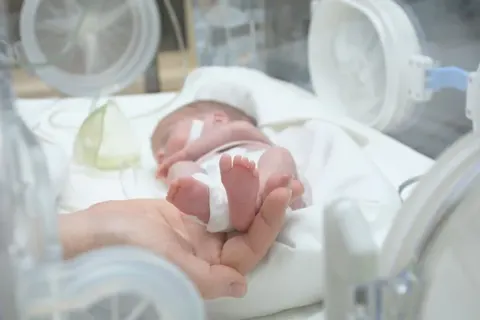 Передчасні пологи в Україні: як виходжують немовлят від 22 тижнів
