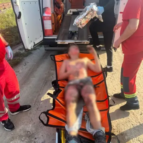 У Львові підліток дістав ураження струмом, залізши на цистерну заради селфі