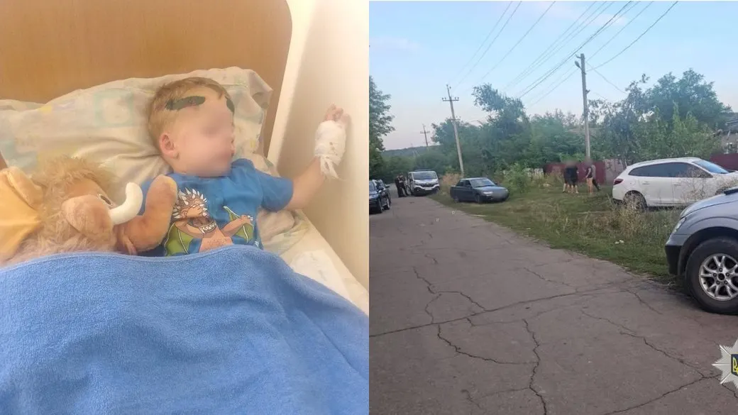 Наїзд на 2,5-річну дитину в Одеській області: що відомо і що робити родині